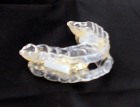 An experimental sleep appliance by lab technician John Feldin (www.oralsleepapnea.com)